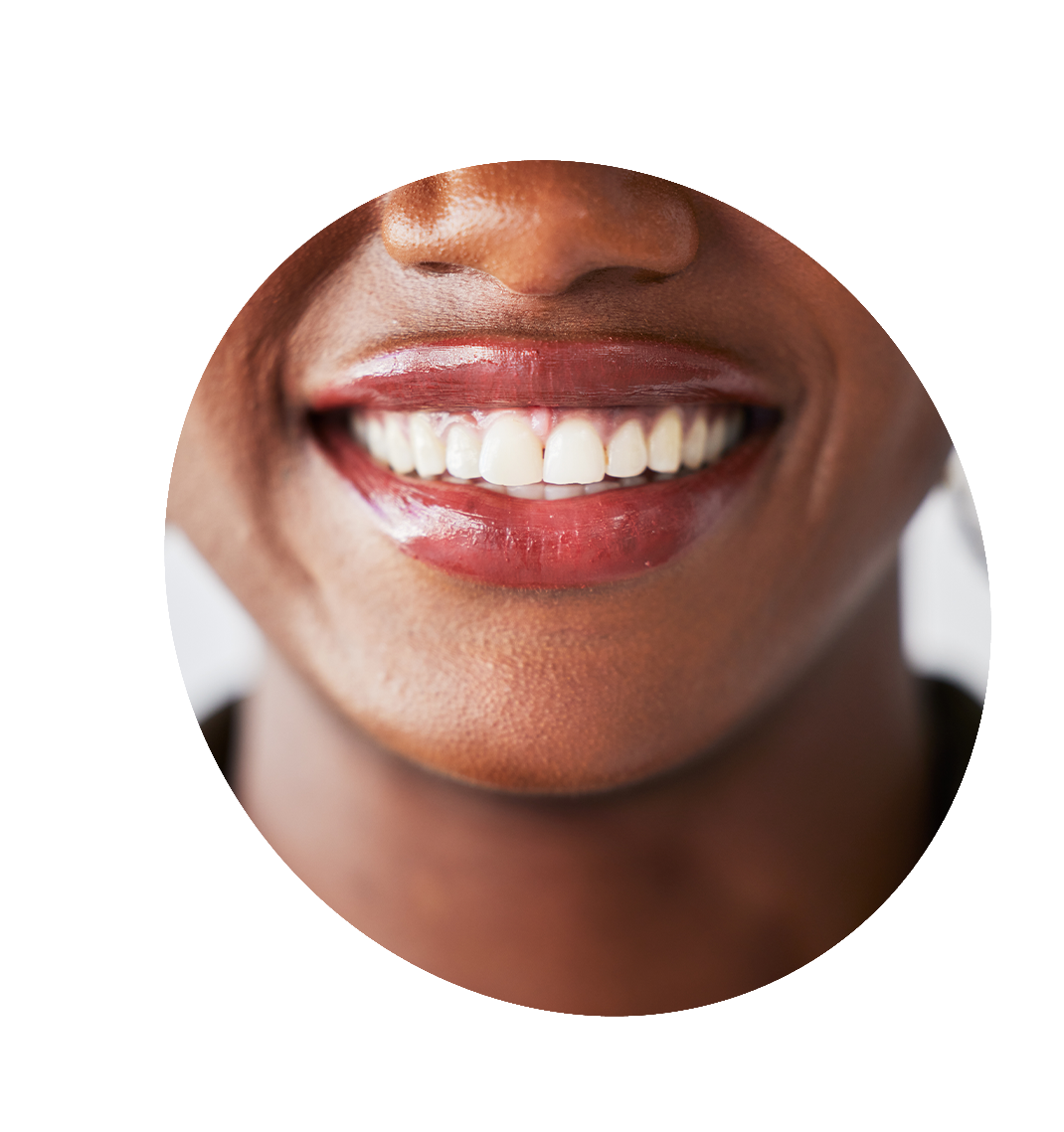 smile makeover bucktown chicago