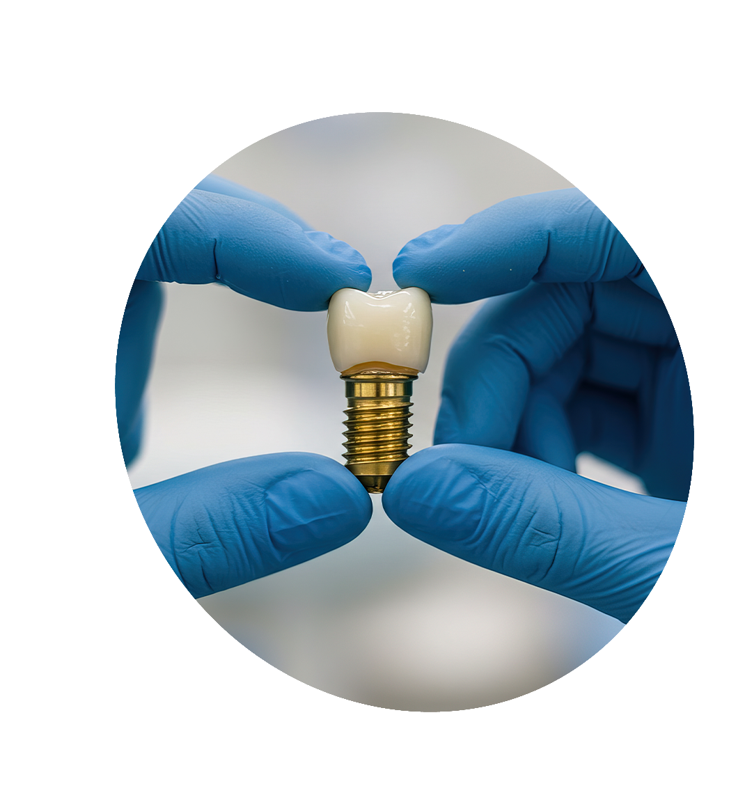 Why Your Dentist Might Not Be the Right Person to Place Your Implant