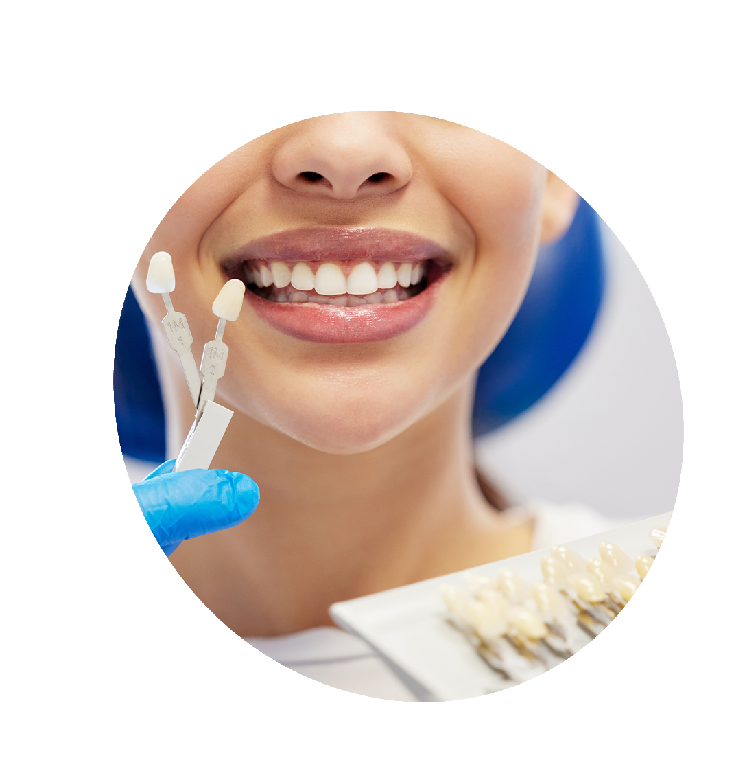 porcelain veneers bucktown chicago