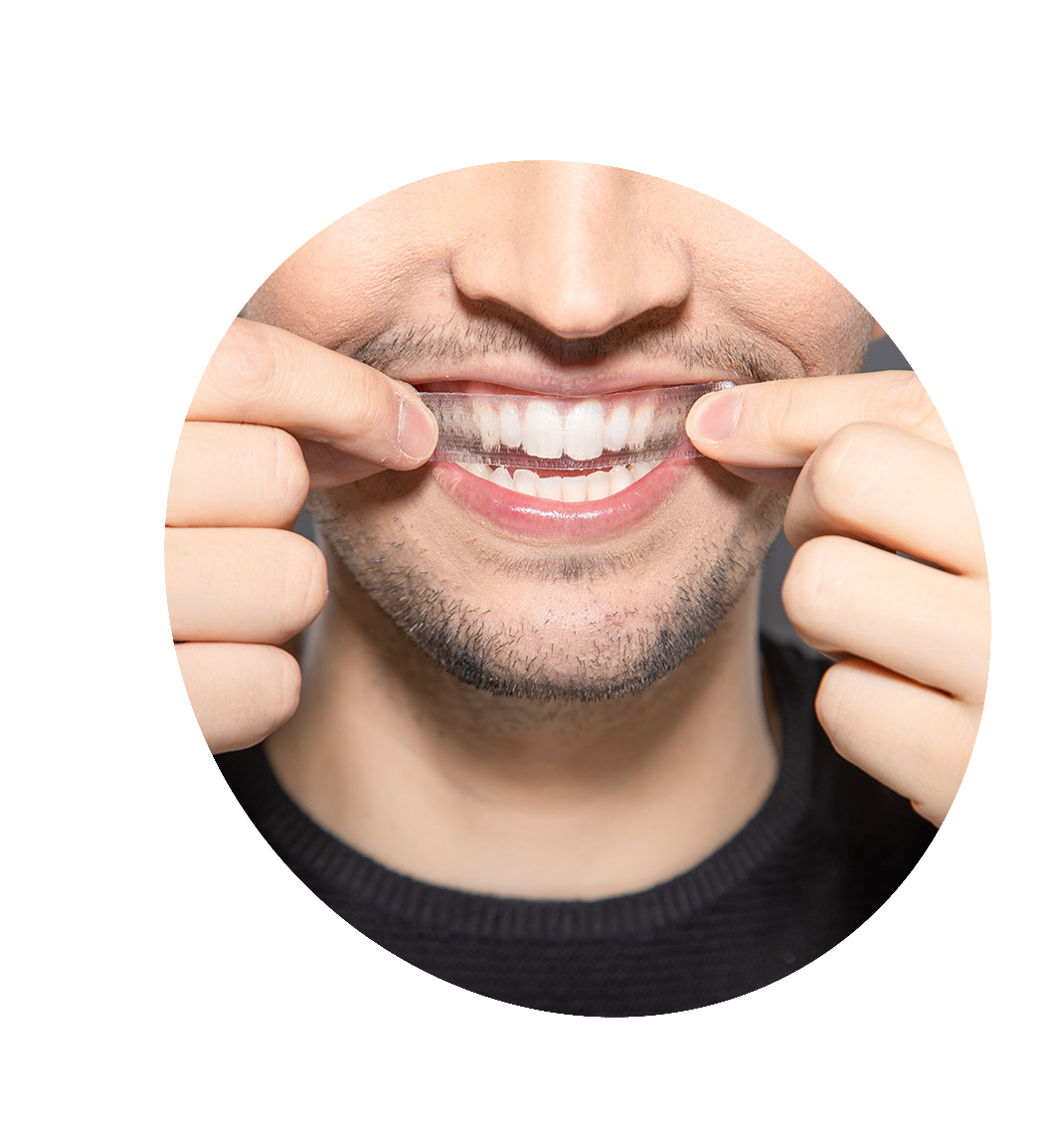 teeth whitening bucktown chicago